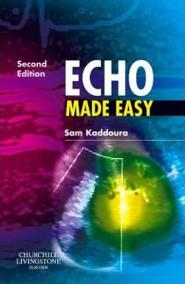 Echo Made Easy 2nd edition