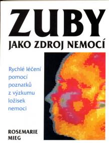 Zuby jako zdroj nemocí