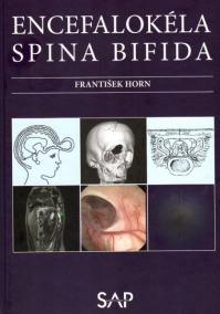 Encefalokéla spina bifida