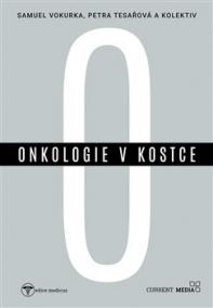 Onkologie v kostce