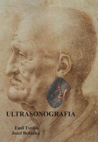 Ultrasonografia